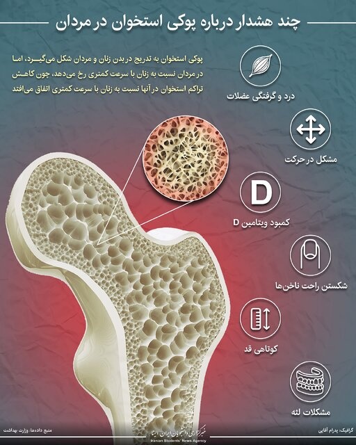 اینفوگرافی/ چند هشدار درباره پوکی استخوان در مردان