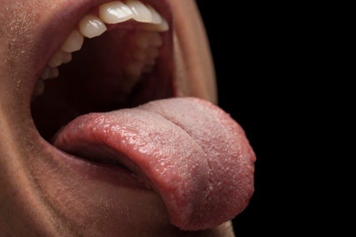 بررسی علل اصلی خشکی دهان دیابت
