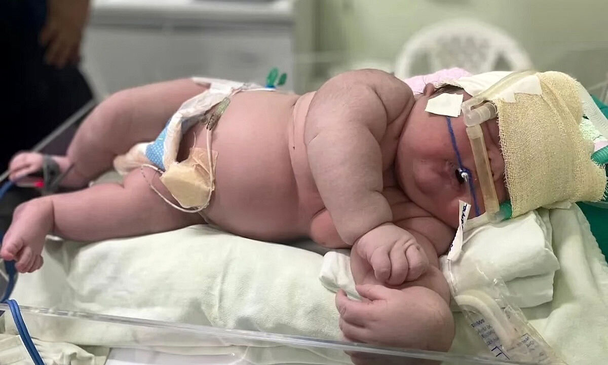 قصور پزشکی جان نوزاد ۱۳ ماهه را در بیمارستان مفید گرفت
