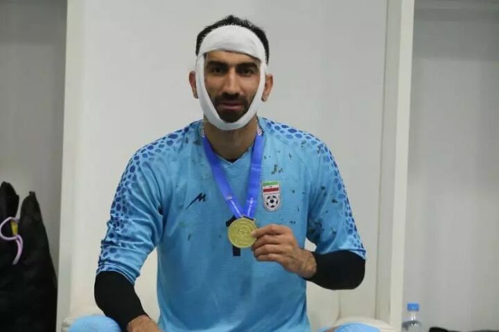 بیرانوند و اعلام شکستگی فک در پست اینستاگرامی بیرانوند و اعلام شکستگی فک در پست اینستاگرامی