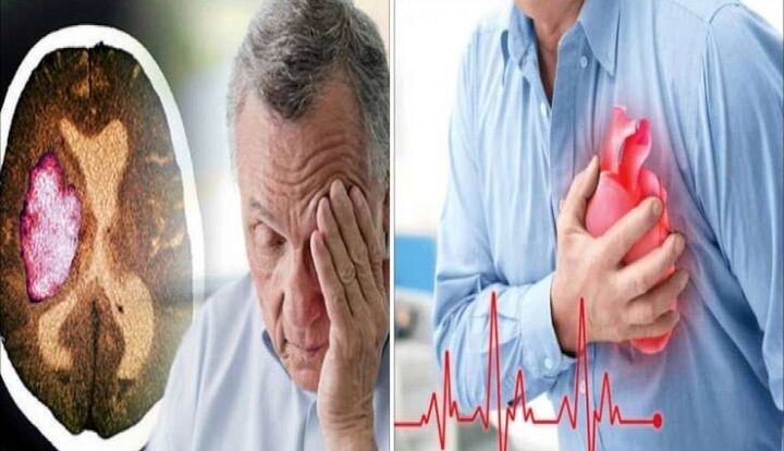 علائم و تفاوت سکته مغزی و قلبی چیست؟ علائم و تفاوت سکته مغزی و قلبی چیست؟