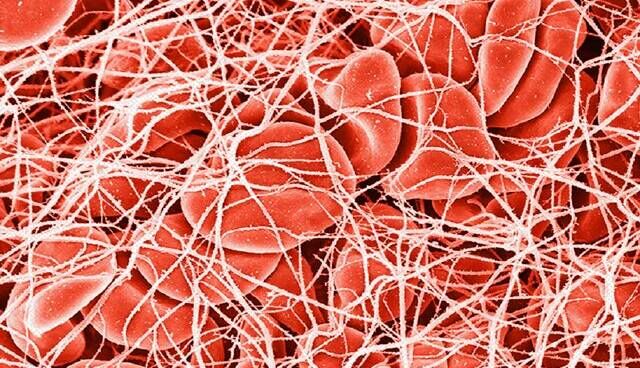 ۶ درمان غذایی برای جلوگیری از غلظت خون ۶ درمان غذایی برای جلوگیری از غلظت خون