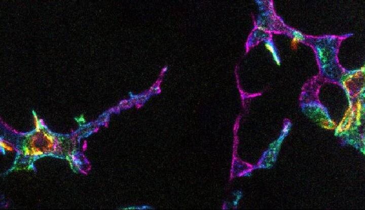 کشف سلولهای ایمنی در چشم انسان کشف سلولهای ایمنی در چشم انسان
