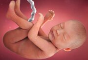 افزایش خطر تولد نوزدان مبتلا به ناهنجاری‌ها و بیماری‌ها ژنتیکی