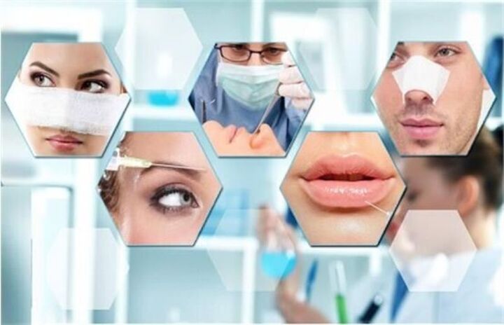 کاهش سن تمایل به زیباییهای ساختگی، آسیبی نیازمند تدبیر کاهش سن تمایل به زیباییهای ساختگی، آسیبی نیازمند تدبیر