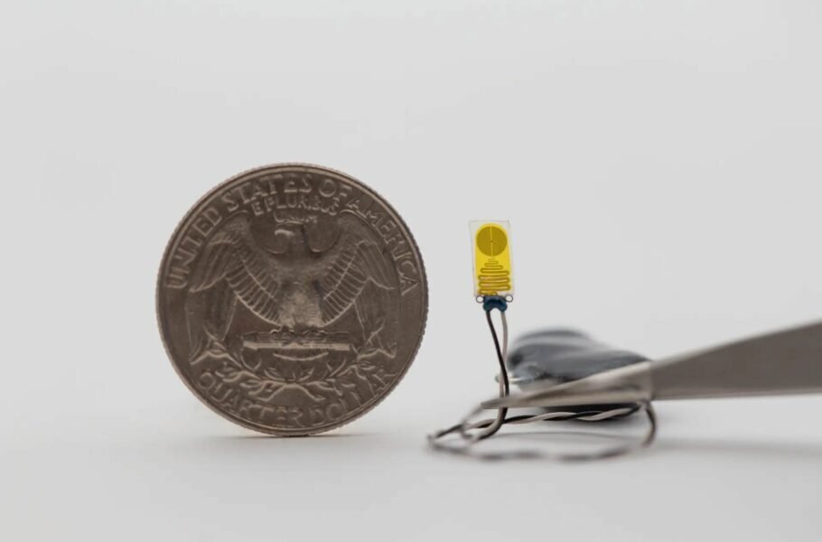 حسگری بینهایت نازک که روی کلیه نصب میشود