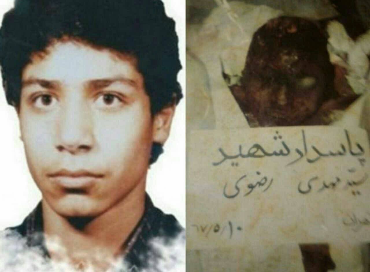 روایت شهیدی که منافقان زنده پوستش را کندند