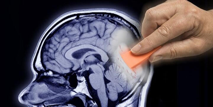 آلزایمر، جدیترین چالش آینده کشور است آلزایمر، جدیترین چالش آینده کشور است