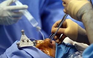 پشتپرده افزایش عملهای نامتعارف؛ از لب شتری تا دماغ خوکی پشتپرده افزایش عملهای نامتعارف؛ از لب شتری تا دماغ خوکی