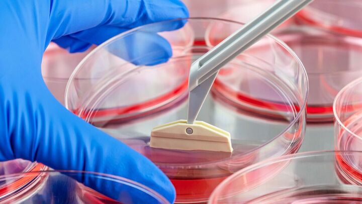 «داربستهای سهبعدی نانویی» راهحل درمان رایجترین علت نابینایی «داربستهای سهبعدی نانویی» راهحل درمان رایجترین علت نابینایی