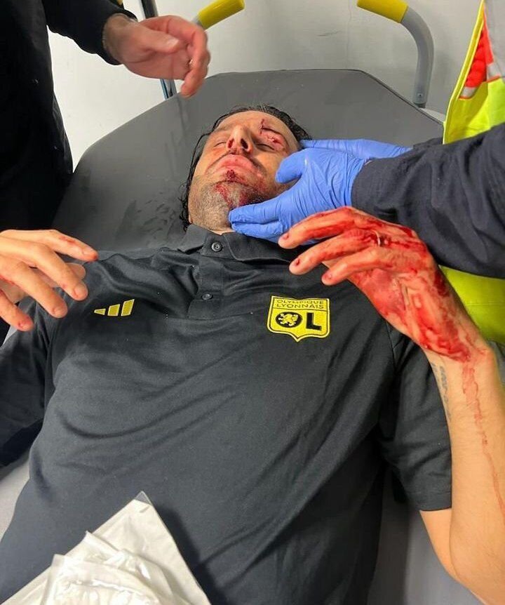 آشوب در بازی لیون و مارسی؛ حمله به گروسو بازی را لغو کرد (ویدیو)