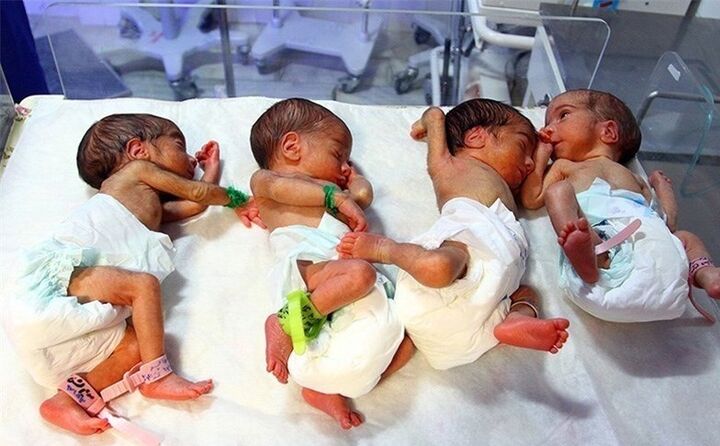 ششمین 4 قلوهای امسال اصفهان به دنیا آمدند ششمین 4 قلوهای امسال اصفهان به دنیا آمدند