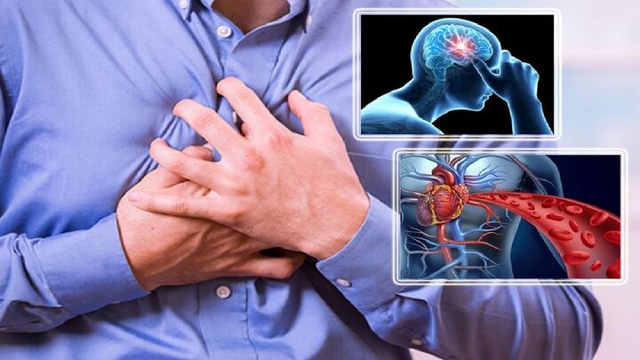 سکته قلبی و مغزی از مهمترین تبعات گرفتگی عروق سکته قلبی و مغزی از مهمترین تبعات گرفتگی عروق