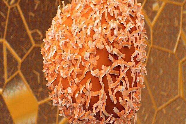 جلوگیری از سرطان روده با داروی دیابت و چاقی جلوگیری از سرطان روده با داروی دیابت و چاقی