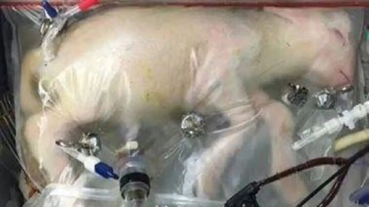 عرضه رحمهای مصنوعی برای نوزادان نارس به زودی عرضه رحمهای مصنوعی برای نوزادان نارس به زودی