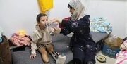 روزانه 10 کودک در غزه بر اثر حملات رژیم صهیونیستی معلول می‌شوند