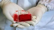 خون بند ناف به‌عنوان منبع ارزشمند سلول‌های بنیادی تاسیس شدند
