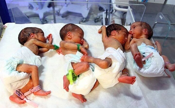 ثبت ۱۶ هزار ولادت چند قلو در کشور در ۵ ماهه نخست امسال ثبت ۱۶ هزار ولادت چند قلو در کشور در ۵ ماهه نخست امسال