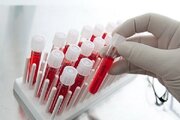 اما و اگرهای پلاسما فروشی