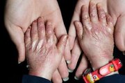 زخم بی‌توجهی بر تن پروانه‌ها