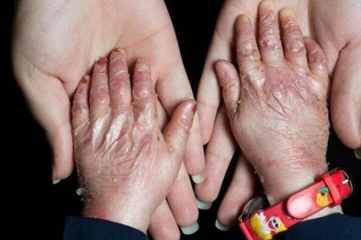 زخم بی‌توجهی بر تن پروانه‌ها