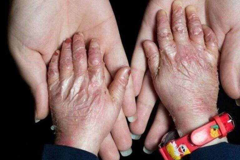 زخم بی‌توجهی بر تن پروانه‌ها