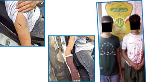 تیغ کشی خونبار ۱۶ سالههای شیشهای تیغ کشی خونبار ۱۶ سالههای شیشهای