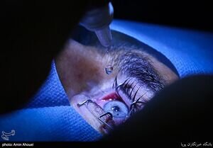 رد پای وزیر اسبق بهداشت در انجام یک جراحی ممنوعه