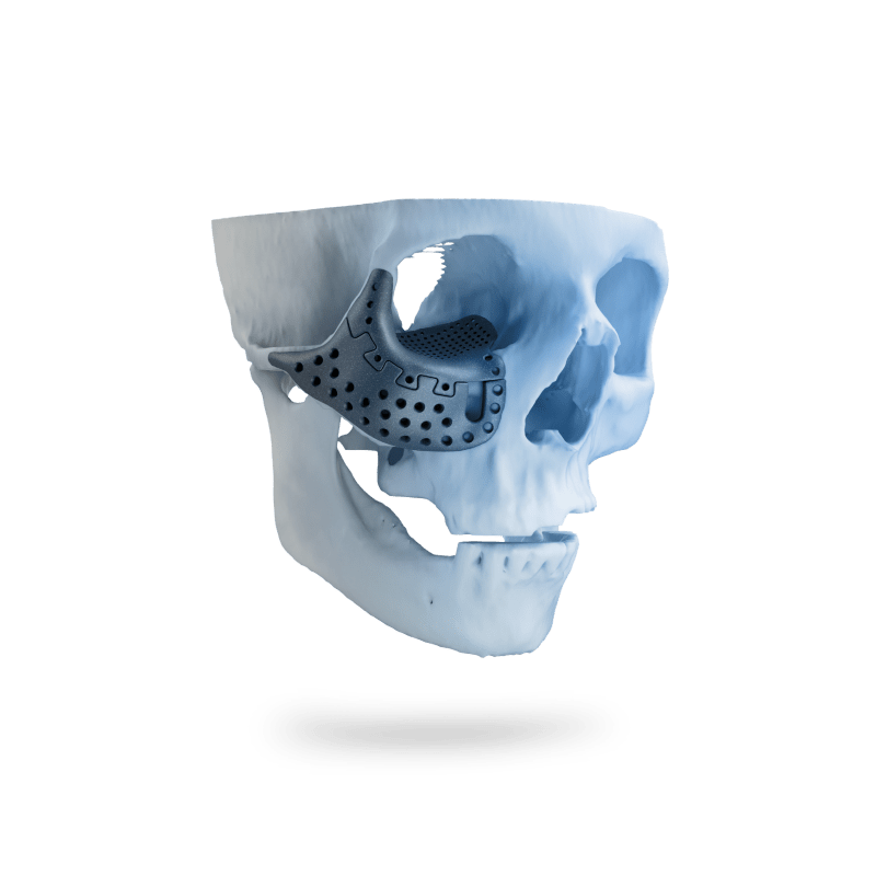 طراحی نسل جدید پرینترهای سهبعدی زیستی و ایمپلنتهای جذبشونده؛ جهشی بومی در مهندسی پزشکی