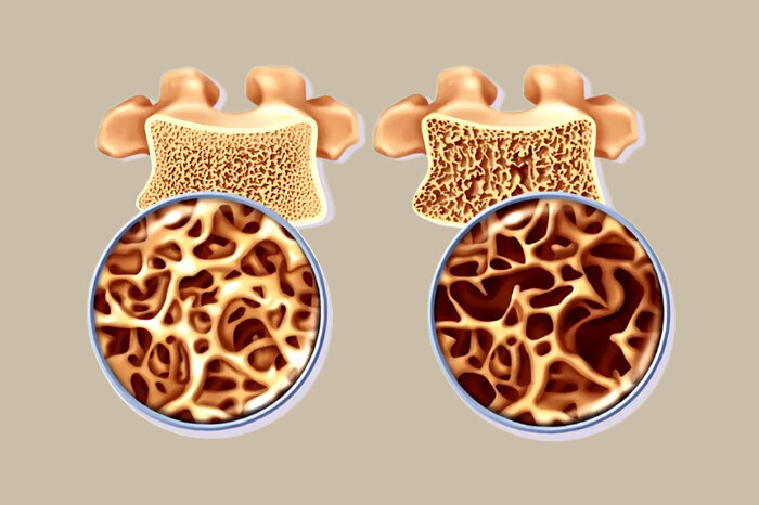کشف تازه‌ای که استخوان‌ها را دوباره زنده می‌کند