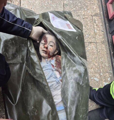 شهادت کودک ۷ ساله در حملات اخیر صهیونی_آمریکایی