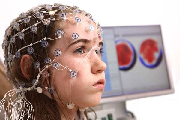 طراحی و تولید بومی الکترود کاشتنی ثبت سیگنال قشر مغز (ECoG)