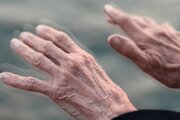 چگونه بفهمیم مبتلا به پارکینسون شدیم؟