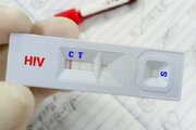 کاهش سهم «اعتیاد» در انتقال HIV