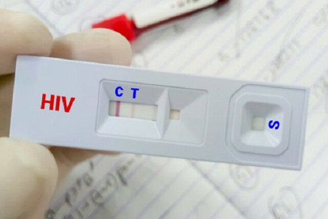 کاهش سهم «اعتیاد» در انتقال HIV