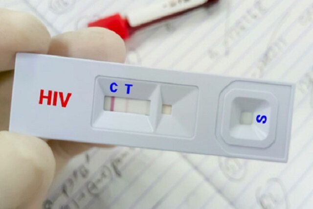 کاهش سهم «اعتیاد» در انتقال HIV