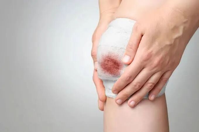 استرس؛ عملکرد سلول‌ها برای ترمیم زخم را مختل می‌کند