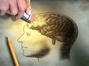 زوال عقل (Dementia) چیست؟