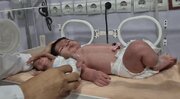 فیلم/تولد دو نوزاد با اختلاف وزن ۱۱ برابری در بندرعباس