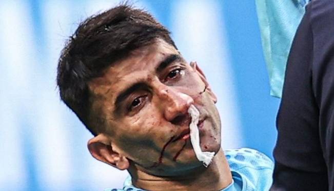  بیرانوند صدای پیشکسوت انگلیس را درآورد
