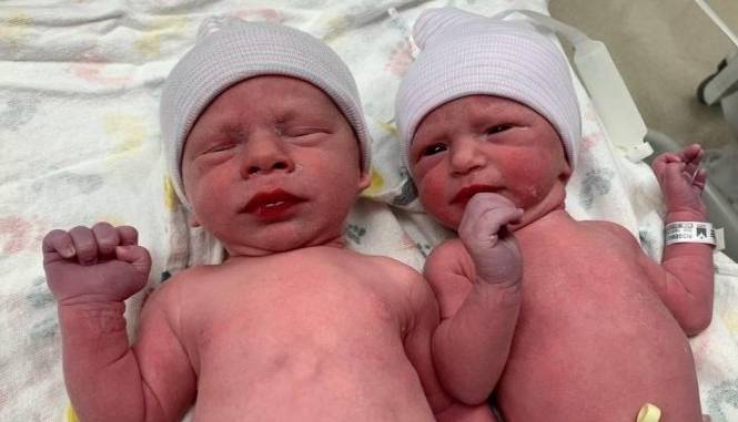 تولد نوزادان دوقلو از تخمک یخ زده 30 ساله